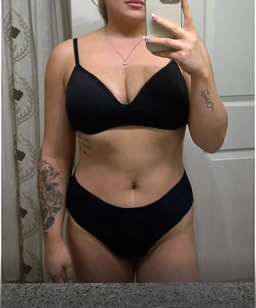 Eden client after doctor-led weight loss.