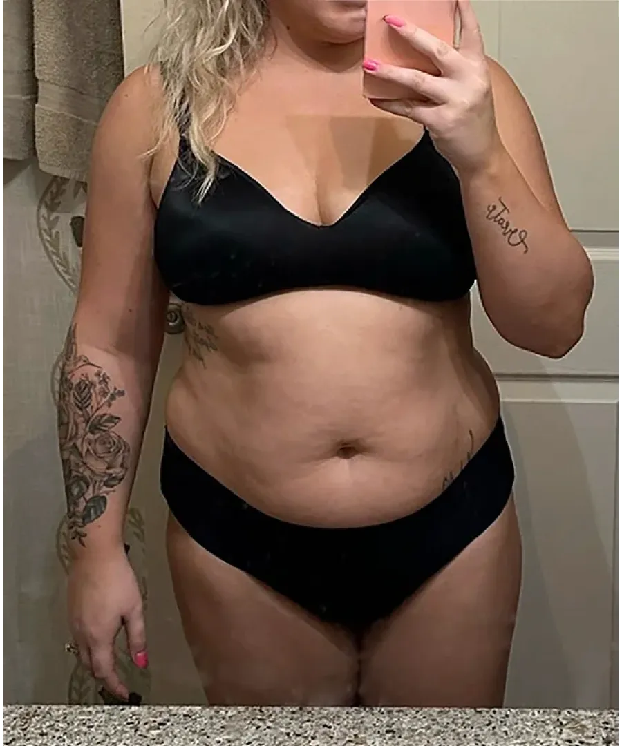 Eden client before doctor-led weight loss